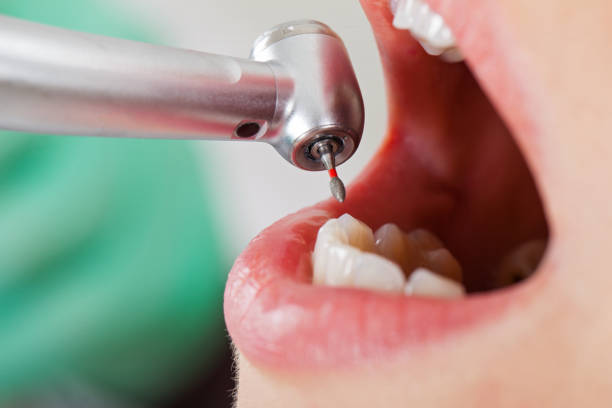 Best Holiday Emergency Dentist in Coldwater, OH